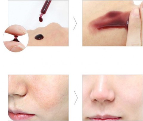 So Natural Кислотная сыворотка с тингл-эффектом For Your Skin Red Peel Tingle Serum