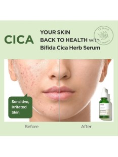 MA:NYO Успокаивающая сыворотка против воспалений Bifida Cica Herb Serum, 50 мл