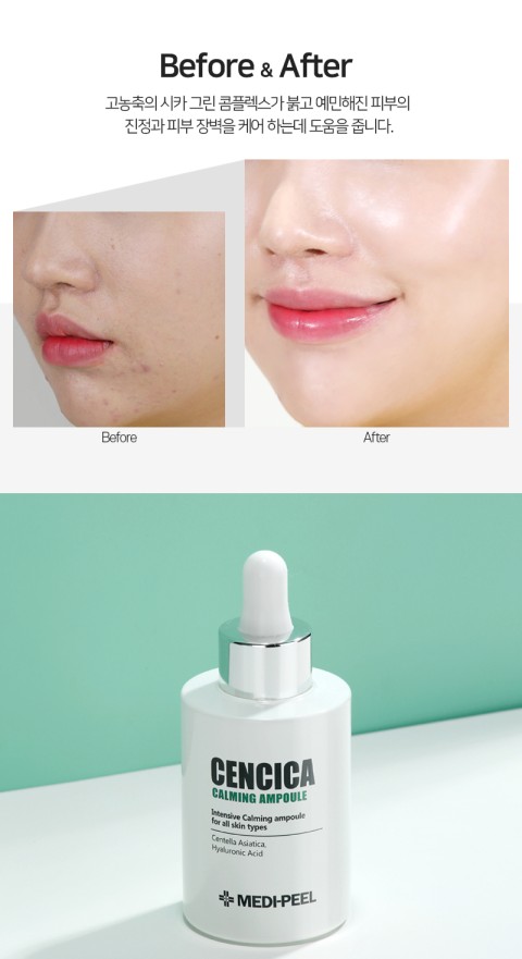MEDI-PEEL Интенсивно успокаивающая ампула для чувствительной кожи с центеллой и полынью Cencica Calming Ampoule, 100 мл