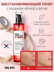 SOME BY MI Тонер для лица восстанавливающий с муцином улитки SOME BY MI SNAIL TRUECICA MIRACLE REPAIR TONER, 135 мл.