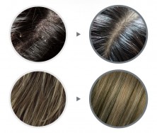 Lador Слабокислотный шампунь против перхоти Anti Dandruff Shampoo, 530 мл.