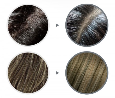 Lador Слабокислотный шампунь против перхоти Anti Dandruff Shampoo, 530 мл.