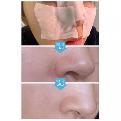Medi-Peel Набор для удаления черных точек Extra Super 9+ Cotton Pad