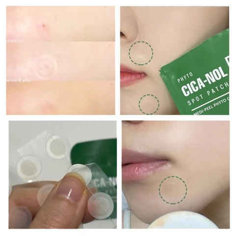 MEDI-PEEL Успокаивающие точечные патчи от прыщей с центеллой Phyto CICA-Nol B5 Spot Patch, 12 мм*12 шт