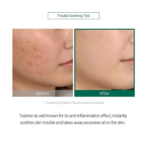 Some By Mi Масло чайного дерева для проблемной кожи 30 Days Miracle Tea Tree Clear Spot Oil, 10 мл